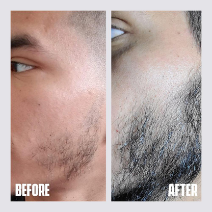 Dr. Alies Professional Beard Growth Oil | Natural Formula with Vitamin E, Almond Oil & Castor Oil